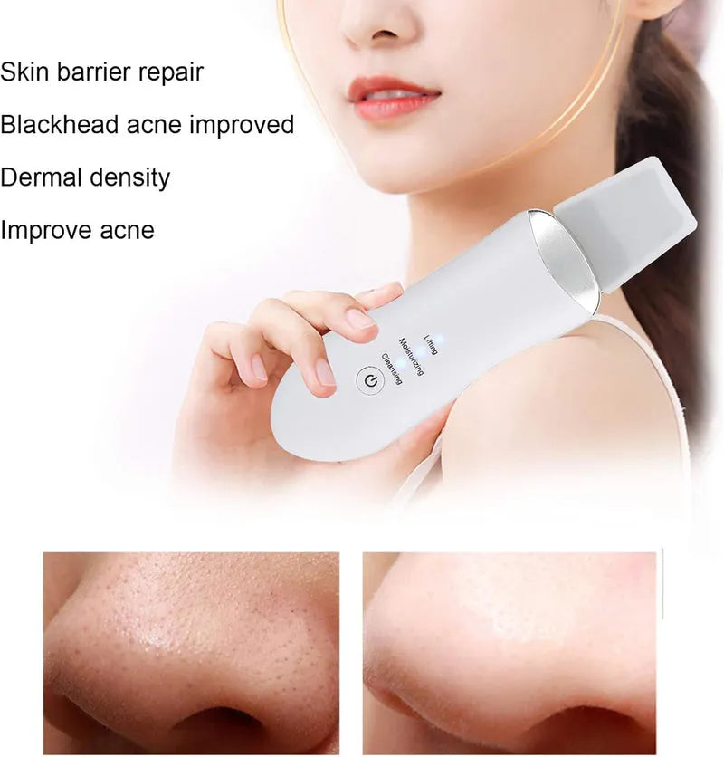 Ultrasonic - Skin Scrubber