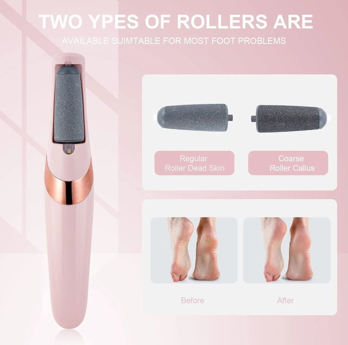 Gulf Orya™ Callus Remover