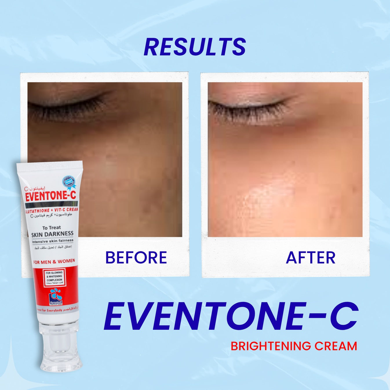 Eventone C Cream ( Skin whitening )