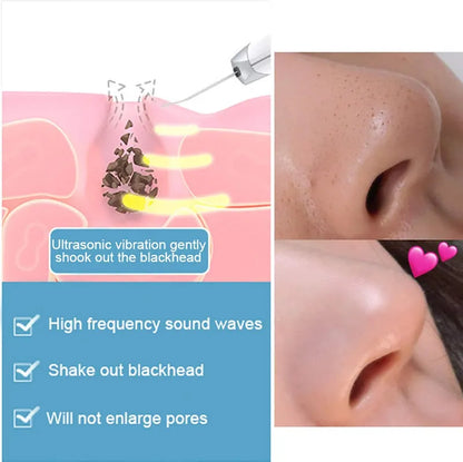 Ultrasonic - Skin Scrubber