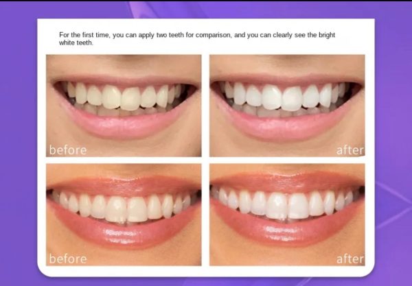 V34 Teeth Whitening Serum